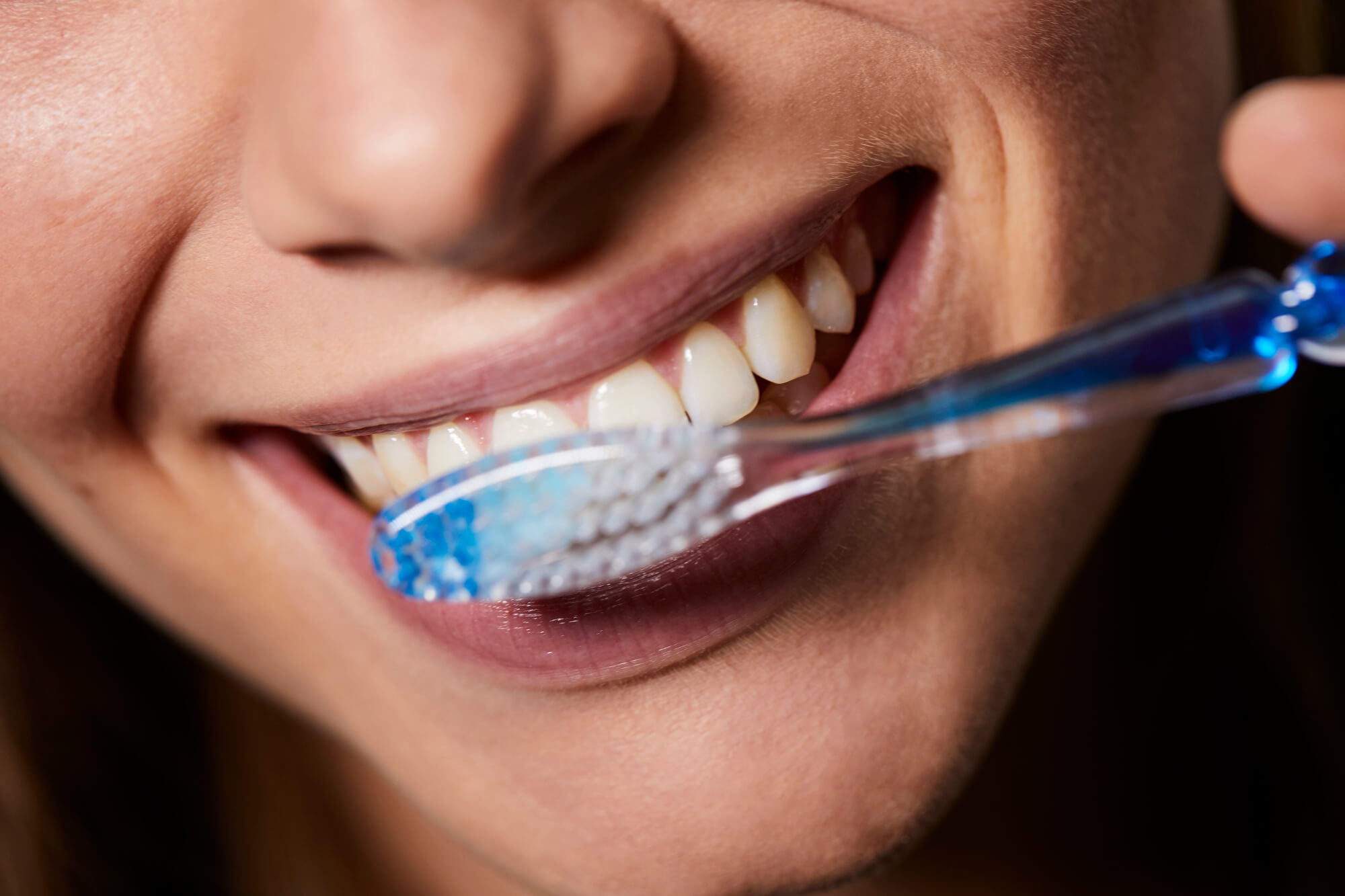 woman undergoing Teeth Whitening in Miami